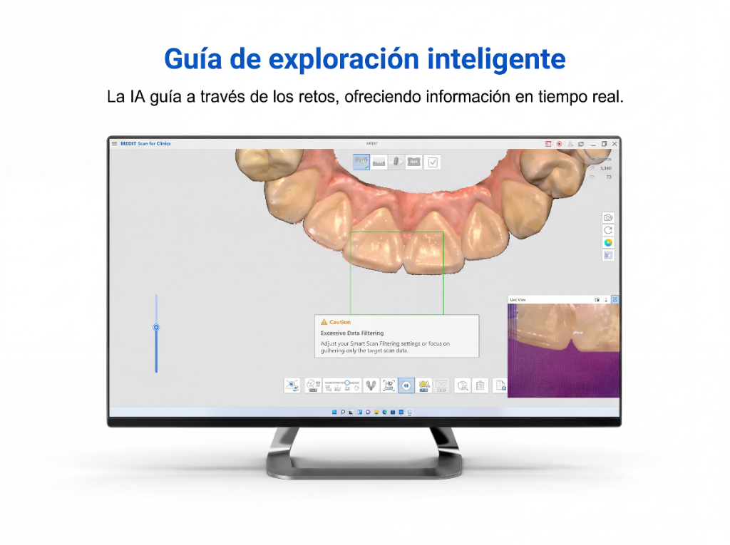 Guía de exploración inteligente en Medit Scan for Clinics