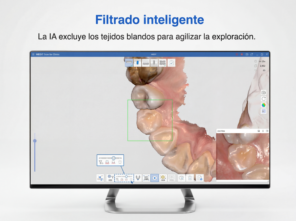 Filtrado inteligente de tejidos blandos con IA