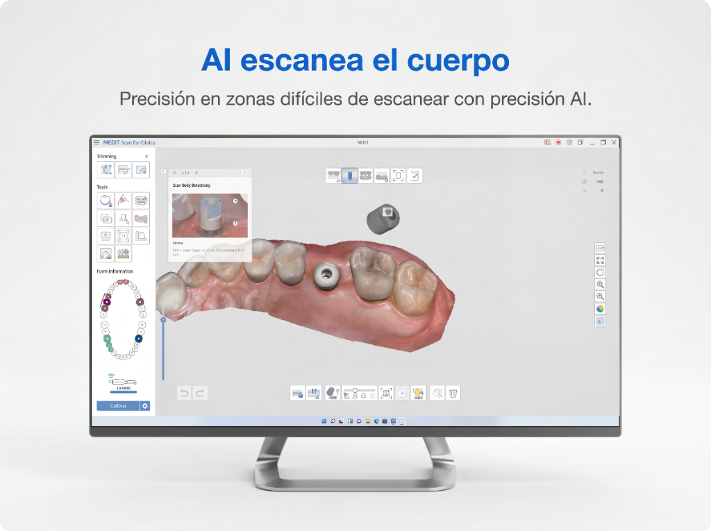 IA escanea el cuerpo del implante en Medit Scan for Clinics